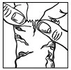 Black and white drawing showing two hands pressing and squeezing the skin to prepare the area for injection
