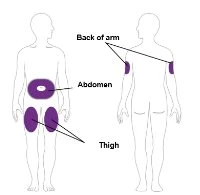 Diagram dwóch sylwetek ludzkich z zaznaczonymi fioletowymi obszarami wstrzykiwania na ramionach, brzuchu i udach oraz etykietami w języku angielskim