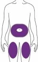 Schema del corpo umano con tre aree viola che indicano i siti di applicazione sull'addome e sulle cosce superiori