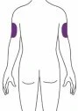 Schema del busto e delle braccia di una persona vista di schiena con due aree viola rettangolari sulla parte superiore di entrambe le braccia
