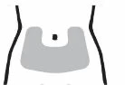 Diagramma stilizzato di un torso umano con una zona grigia a forma di U che evidenzia l'area addominale inferiore intorno all'ombelico