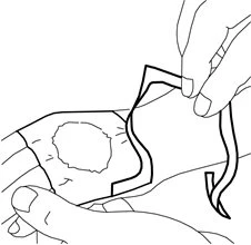 Two hands lifting an adhesive patch to apply it to the skin of an arm or leg in a black and white technical drawing