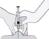 Two hands holding a syringe to inject liquid into a body area represented by a stylized silhouette below