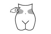 Disegno stilizzato di un torso femminile che mostra due aree grigie sui fianchi e una mano che pizzica la pelle del fianco destro