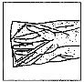 Black and white schematic drawing showing the anatomical structure of an arm and hand with lines indicating tendons and muscles