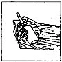Black and white drawing showing a hand holding a syringe to perform an