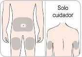 Medical diagram with two human figures showing grey areas on the