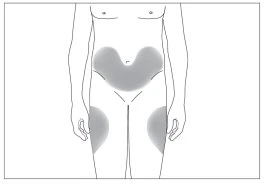 Schematic drawing of a human body with gray areas indicating application zones on the