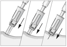 Three sequential illustrations showing the