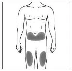 Disegno schematico di un busto maschile con aree grigie evidenziate sull'addome e sulle cosce per indicare i siti di applicazione del farmaco