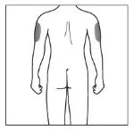 Disegno schematico del busto di un uomo visto di schiena con due aree grigie che indicano i punti di applicazione sulle braccia superiori