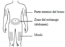 Schema del corpo umano che indica le zone di iniezione: parte esterna del braccio, zona dell'addome e muscolo della coscia