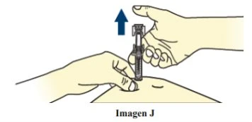 Due mani impugnano un dispositivo medico su una superficie cutanea con una freccia blu rivolta verso l'alto che indica il movimento di estrazione
