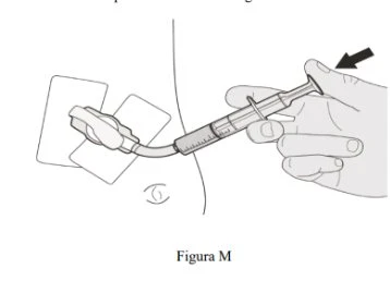 Una mano impugna una siringa per iniettare un farmaco attraverso un tubicino collegato a un dispositivo applicato sulla pelle