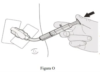 Una mano impugna una siringa collegata a un dispositivo di inalazione tramite un tubo flessibile per l'assunzione del farmaco