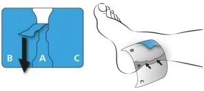 Diagram showing how to apply a tape strip to a foot, with a cross-section indicating the direction of pull between areas A, B, and C
