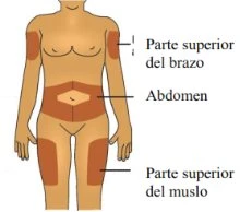 Diagramma del corpo umano che indica le zone di iniezione sulla parte superiore del braccio, sull'addome e sulla parte superiore della coscia