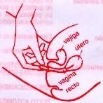 Disegno anatomico in rosso che mostra la posizione della vescica, dell'utero, della vagina e del retto all'interno del corpo femminile