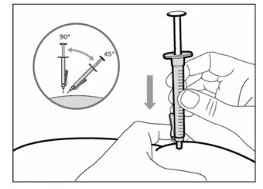 Disegno tecnico che mostra una mano che impugna una siringa per un'iniezione e un dettaglio circolare che indica l'angolo di 45 o 90 gradi