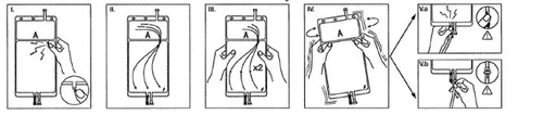 Sequenza di cinque diagrammi illustrativi che mostrano le fasi di utilizzo di un dispositivo medico con mani che lo impugnano e applicano pressione