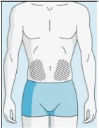 Disegno schematico di un torso maschile con due aree tratteggiate sulla parte inferiore dell'addome che indicano zone di applicazione del farmaco