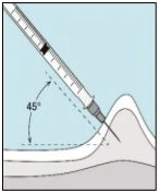 Diagramma che mostra una siringa inclinata a 45 gradi rispetto alla superficie della pelle per l'iniezione nel tessuto sottocutaneo