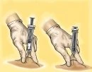 Two gloved hands holding a syringe to perform two different subcutaneous injection techniques on the skin of the body