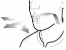 Schematic drawing of a profile view of a face with arrows indicating downward movement of the jaw and throat