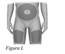 Diagram of a human body with circular gray areas on the skin indicating injection sites