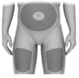 Diagramma del corpo umano che mostra le aree di applicazione evidenziate in grigio sull'addome e sulla parte superiore delle cosce