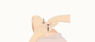 Illustrazione di una mano che tiene una siringa per iniettare un farmaco nel gluteo di una persona con una freccia che indica la direzione dell'iniezione