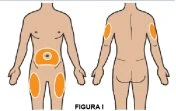 Diagramma di due corpi umani che mostra le zone di iniezione evidenziate in arancione sull'addome, sulle cosce e sulla parte superiore delle braccia