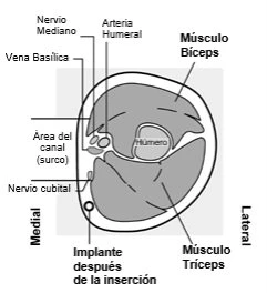 Diagramma anatomico della sezione trasversale del braccio con nervo mediano, arteria umbrale, vena basilica, muscoli bicipite e tricipite e omero