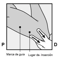 Disegno schematico di un braccio con due punti neri indicanti la marca di guida e il luogo di inserzione per l'iniezione medica