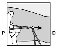 Diagramma che mostra una mano che tiene una siringa con l'ago inserito nella pelle con una freccia nera rivolta verso destra tra P e D
