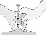 Two hands holding a syringe in vertical position to inject the contents through the