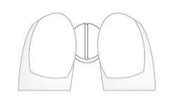 Disegno schematico in bianco e nero di una capsula farmaceutica divisa in due metà simmetriche con una linea di separazione centrale