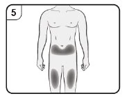 Schematic of a male body with dark areas highlighted on the