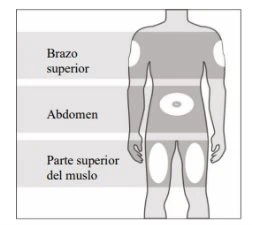 Human body diagram with white areas indicating injection sites on upper arm, abdomen, and upper thigh