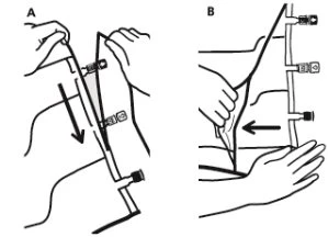 Two-step medical diagram showing how to prepare and apply a device with small connectors onto a skin surface using hands and arrows