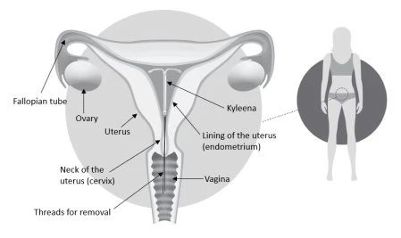 Schemat anatomiczny kobiety pokazujący