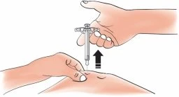 A hand holds a syringe with the needle pointing toward the skin while preparing for injection