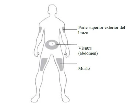 Human body diagram highlighting gray areas on upper arm, abdomen, and thigh with corresponding descriptive labels in Spanish