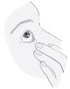 Line drawing of a hand gently pressing the area between the lower eyelid and the eyeball