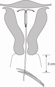 Diagramma medico che mostra l