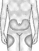 Schematic drawing of a human body highlighting with shaded areas the