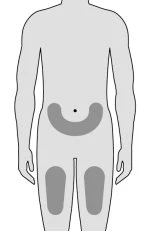 Diagram of a stylized human body with gray areas indicating the lower abdomen and upper thighs