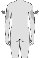 Schematic drawing of torso and arms of a human figure from the back with gray arrows indicating application
