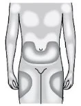 Diagramma del corpo umano maschile con aree grigie che indicano zone di applicazione sul petto, sull'addome e sulle cosce