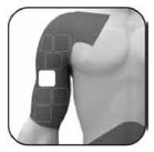 Medical diagram showing a grid patch applied to the upper arm and shoulder of a male human torso
